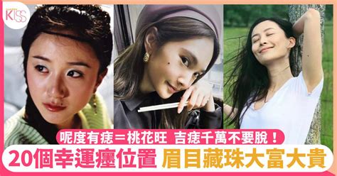 頭頂有痣女|吉痣20個幸運位置＋辨別死痣！額頭有痣會大富大貴、。